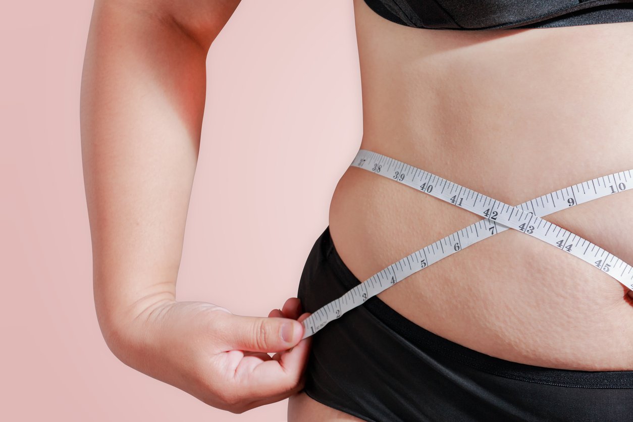 abdominoplastie Tunisie avant et après